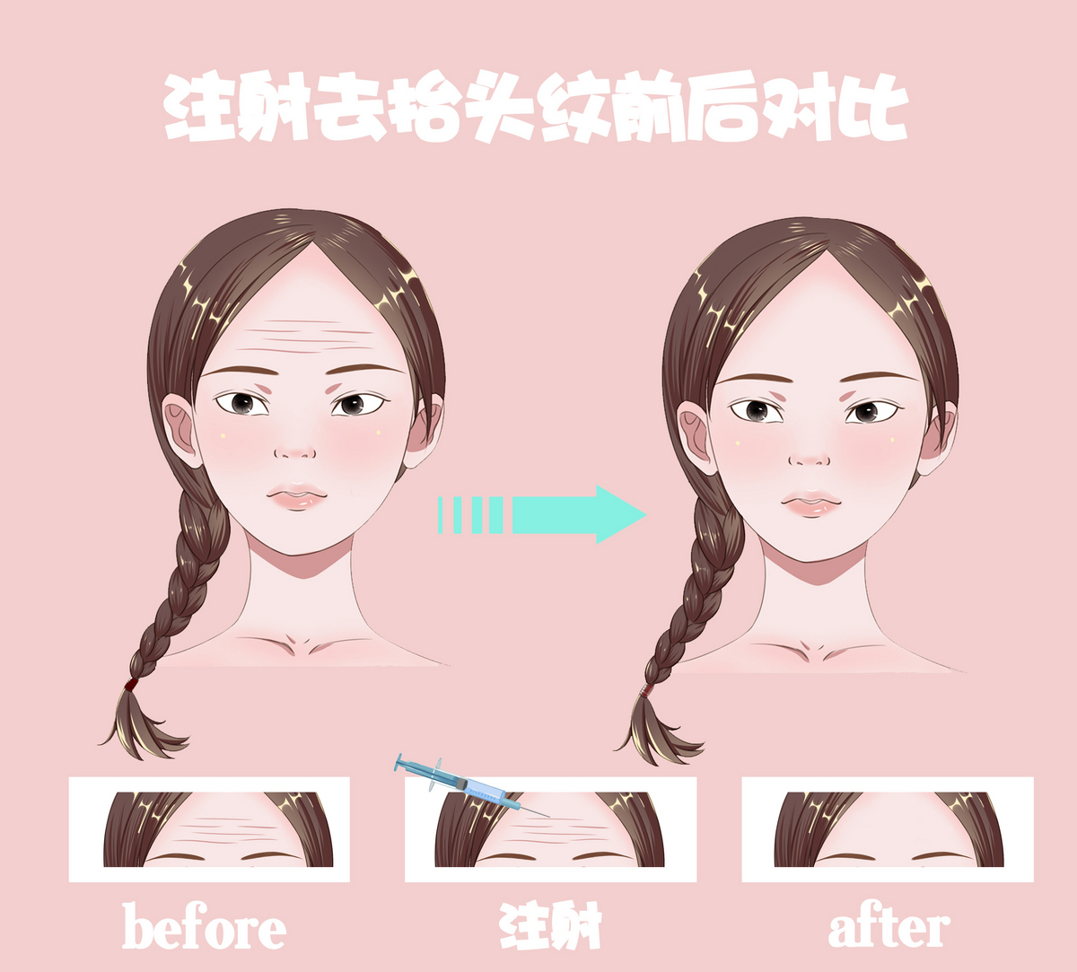 脸部凹陷还下垂松弛做全脸填充吗,脸部凹陷填充用什么填充最好