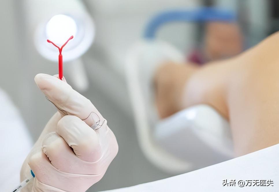 女性上环的全过程，看完心疼了！男女都要好好看看，珍惜眼前人！