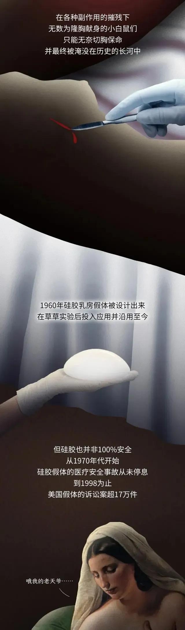 第一个隆胸的女人,全球最红隆胸女人