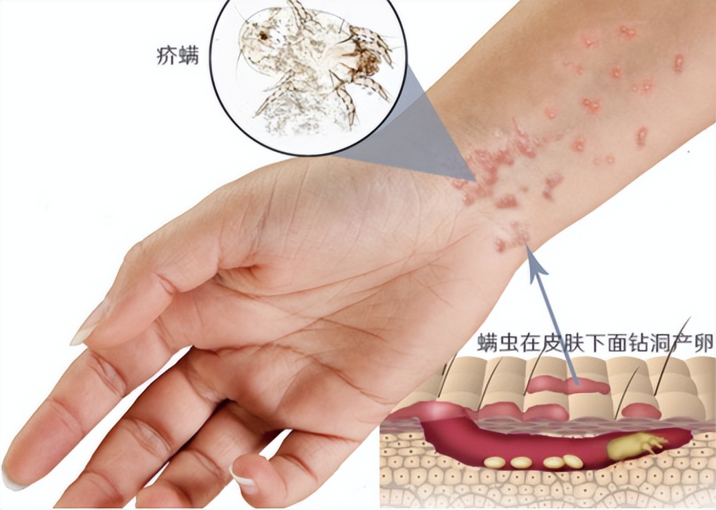 发现寄生虫要报警吗,报警后为什么知道我的详细地址