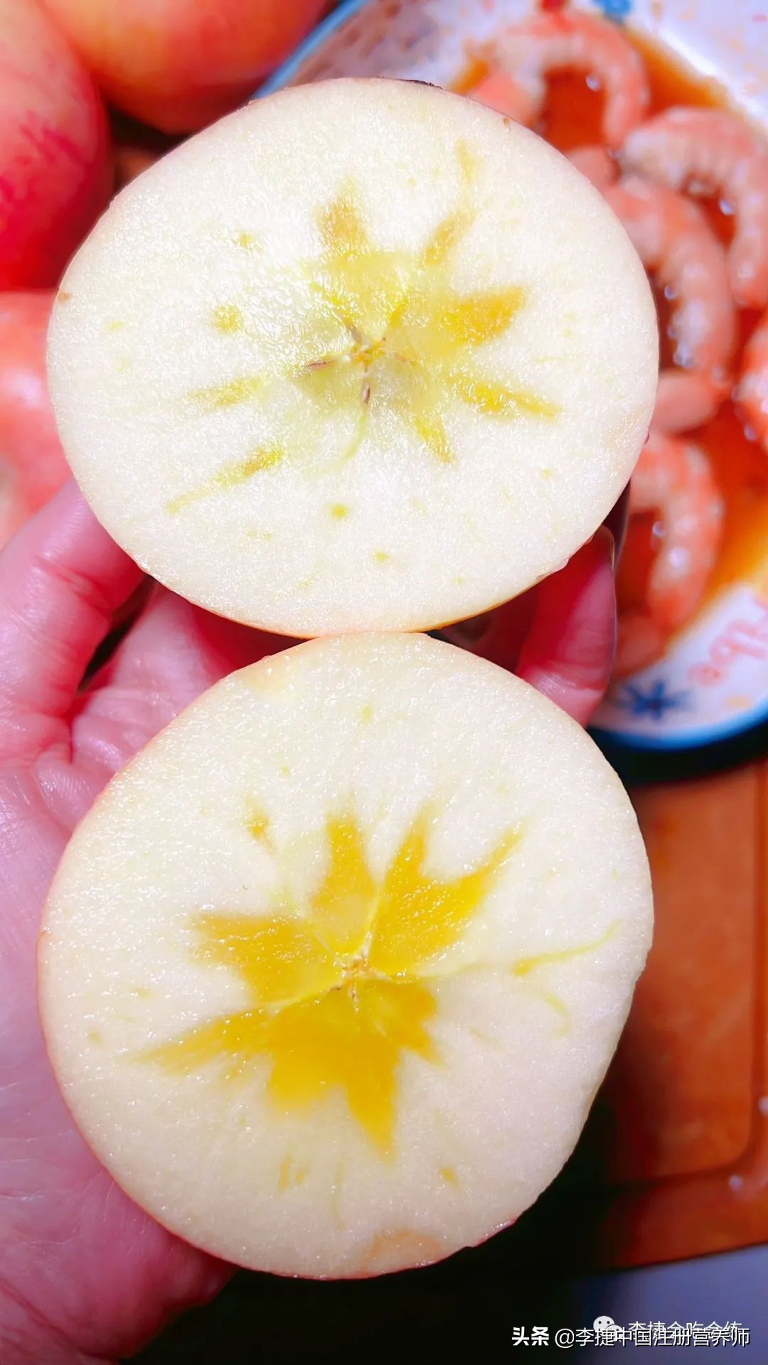 膳食纤维糖有用吗,膳食纤维丰富有益健康