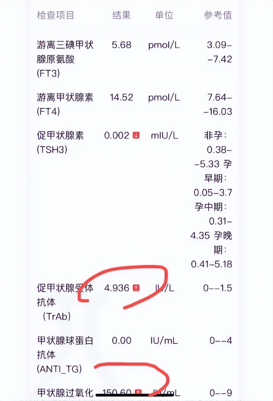 甲亢危重自救,得了甲亢怎么自救