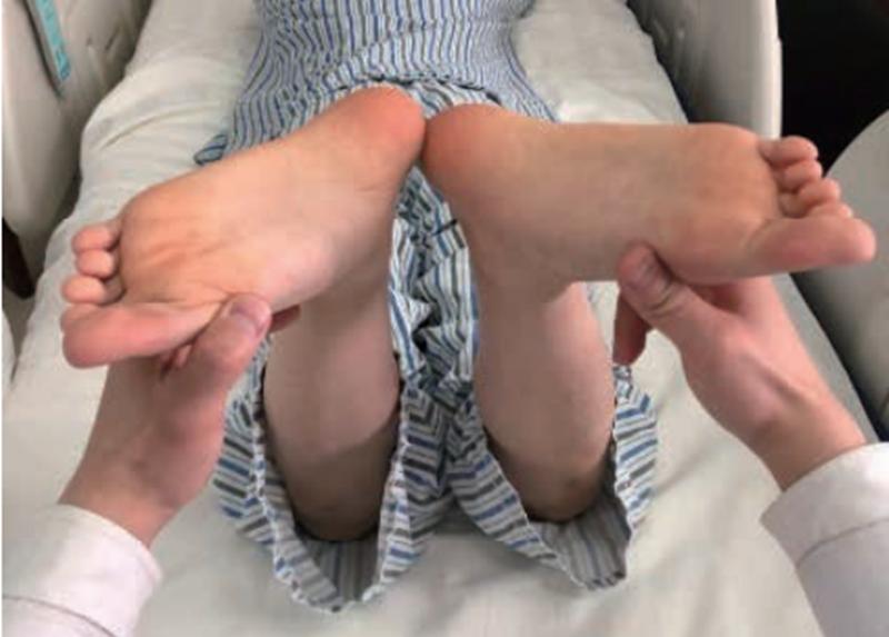 膝关节前交叉韧带损伤怎么治,十字交叉韧带损伤如何解决