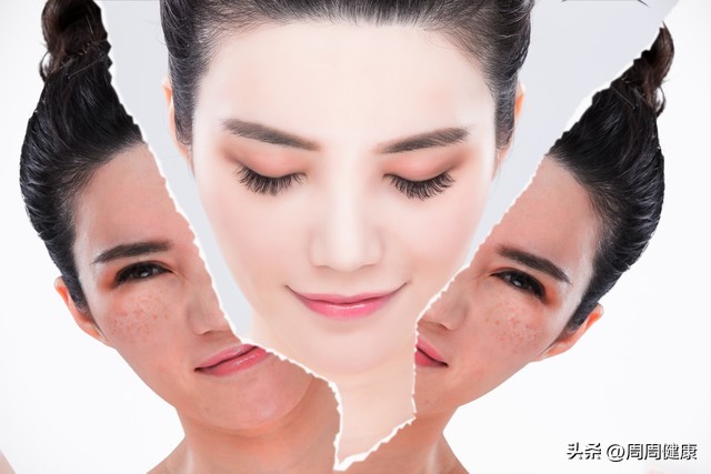 哪款美白祛斑霜真的可以祛斑,女士面膜补水美白祛斑抗皱祛斑霜