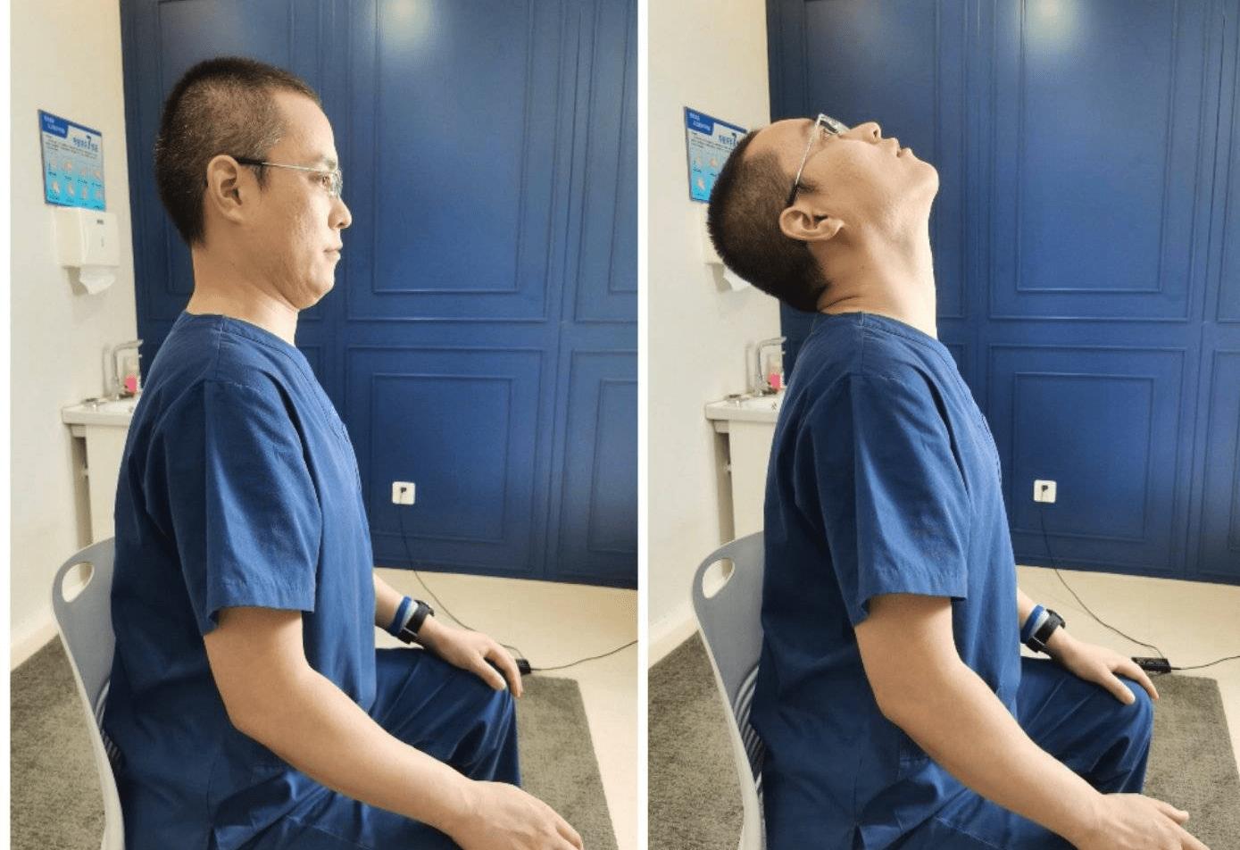 中医扎针治疗偏头痛,夹脊脉冲电针疗法