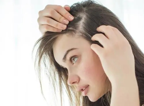 脱发头屑多的原因和治疗方法,头皮油痒有头屑有红疙瘩脱发