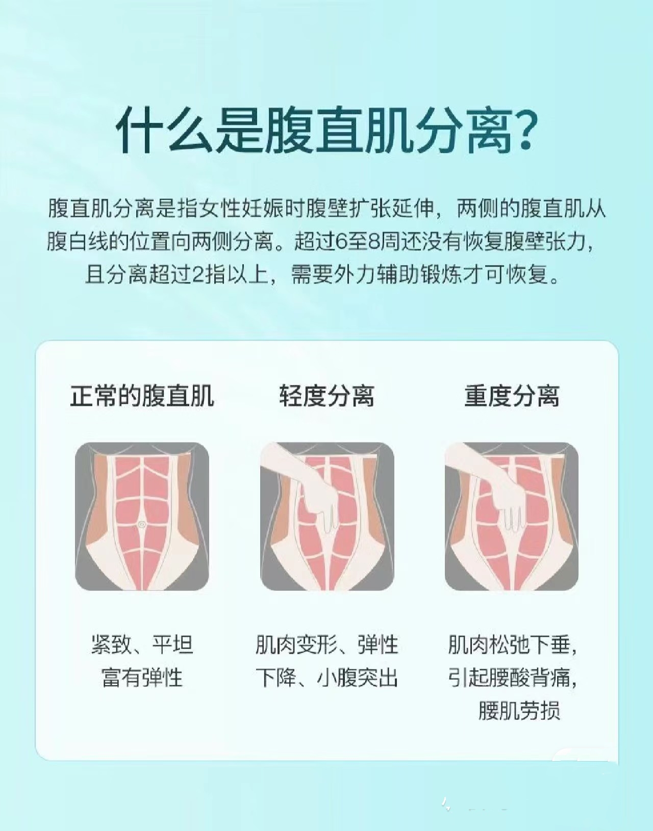 做腹壁整形后的真实案例,腹壁整形修复后的效果图
