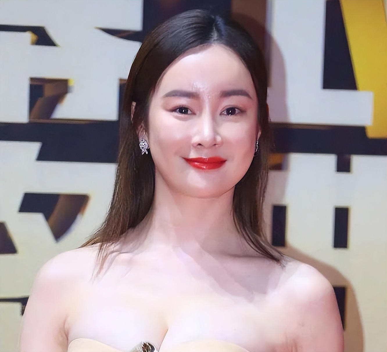 整容过度垮脸的女星,整容失败的蛇精脸女演员