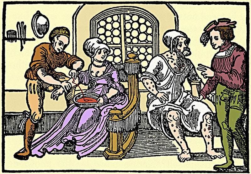 中世纪黑暗医疗脑洞大开，放血只是常规，哪里是看病分明是玩命！