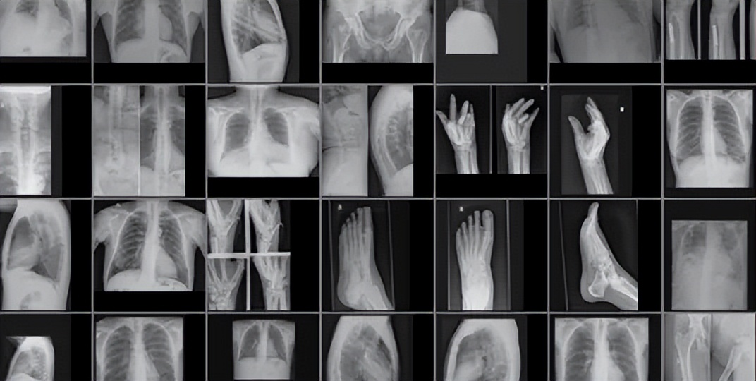 医学影像目标检测框架,开源数据集目标检测