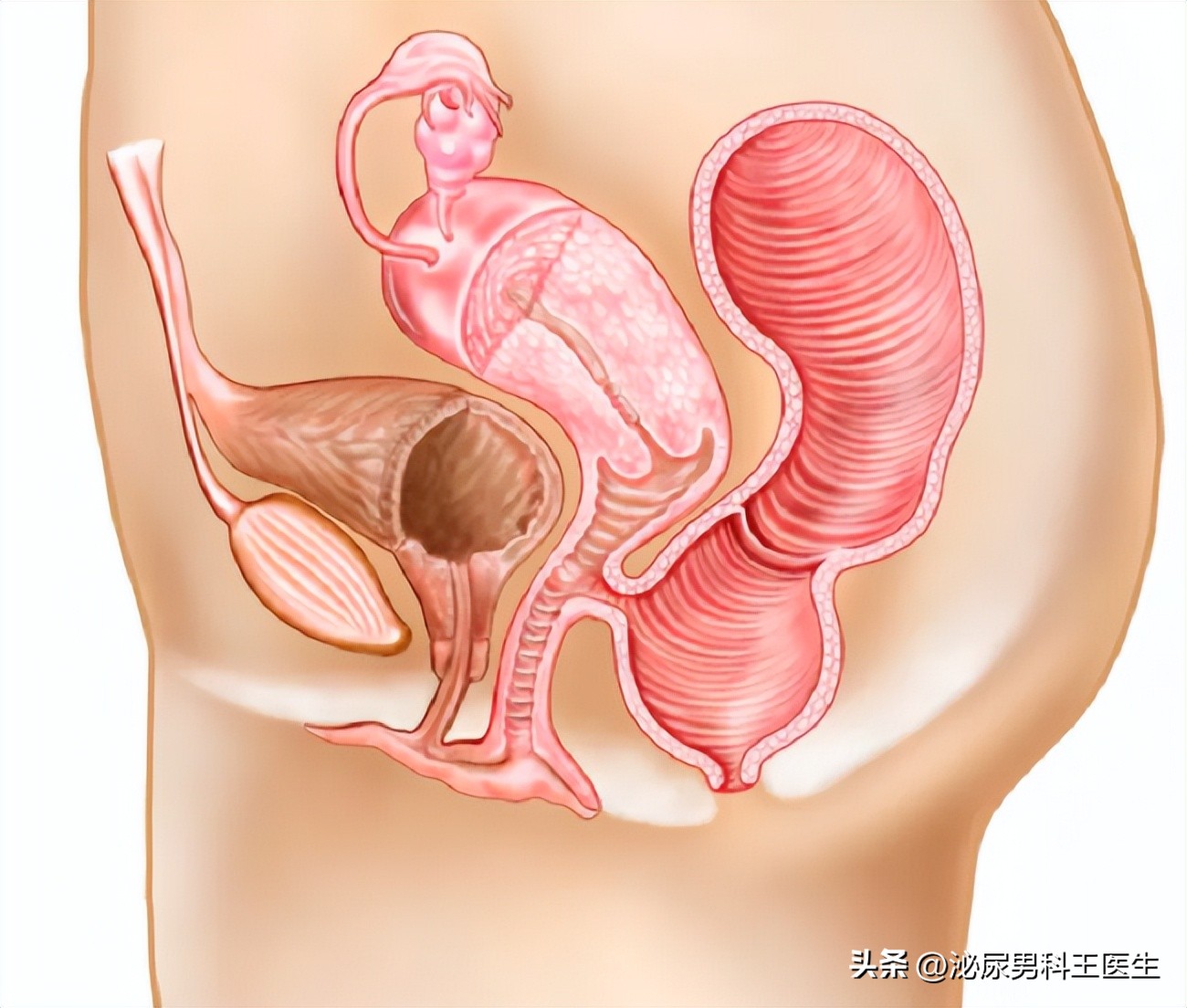 子宫脱垂的主要原因如何治疗好呢,子宫脱垂的主要原因是