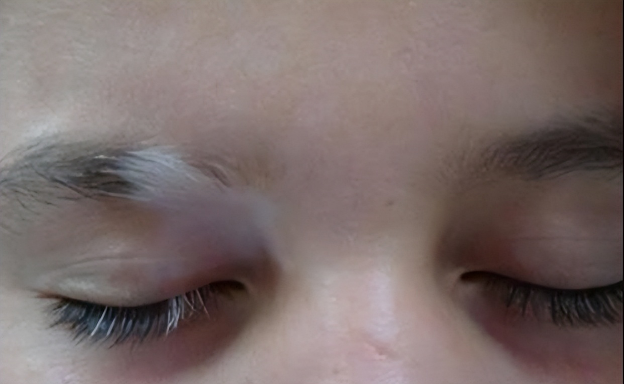 阴毛有何作用？要刮掉吗？从黑变白表示着什么？不要羞于了解