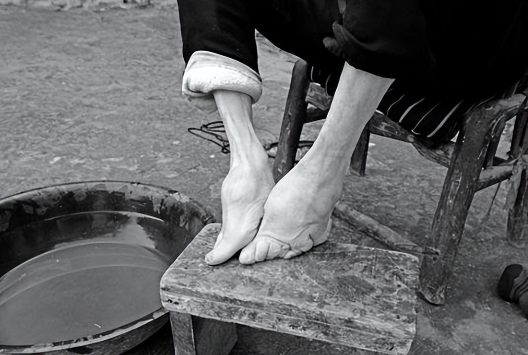 一块裹脚布的前世今生,论中国裹脚布的由来