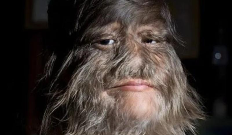 美国女孩艾米丽在中国,美国小女孩艾米丽现在长大了