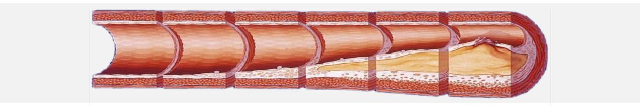 勃起功能障碍---别忽略了是糖尿病惹的祸怎么办..