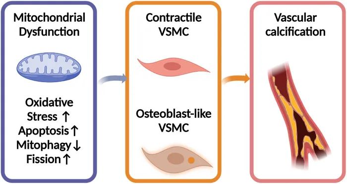 血管钙化的治疗方案,血管钙化的近年研究现状