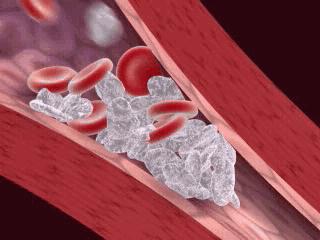 如何快速改掉跷二郎腿的习惯,为什么大家喜欢翘二郎腿