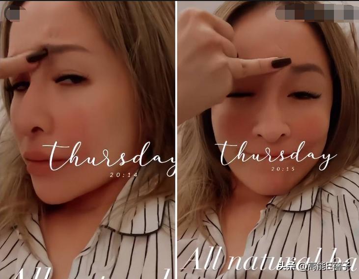 台湾艺人整形记：削骨换脸小场面，嫁给医师保修终身