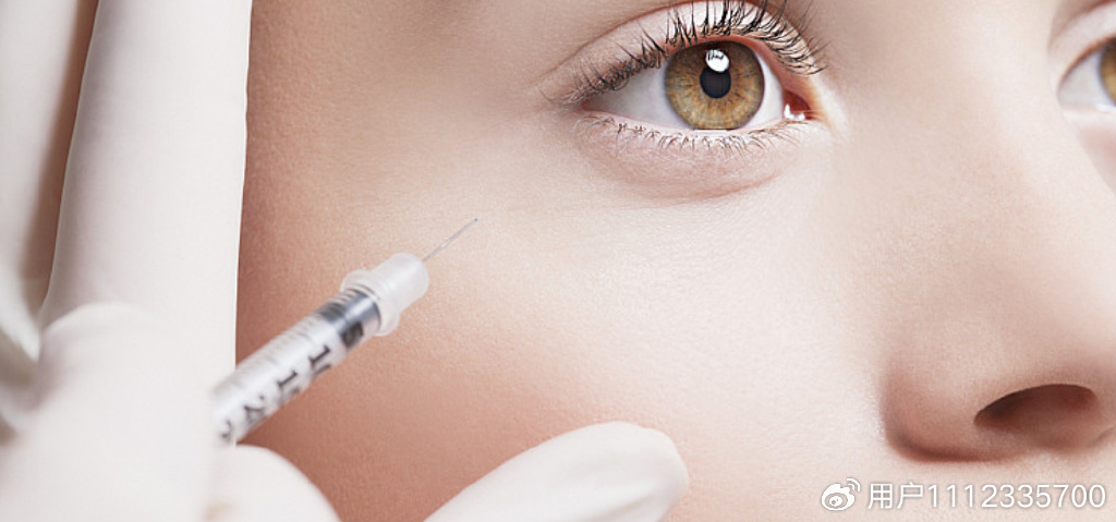 肉毒素打的太频繁,为什么那么多人打肉毒素