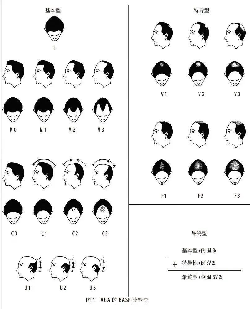 儿童掉头发掉得厉害是什么原因,女生头发掉得厉害是什么原因