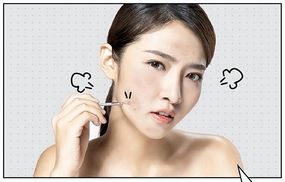 萃雪肤祛痘产品对闭口粉刺有用吗,萃雪肤祛痘精华液