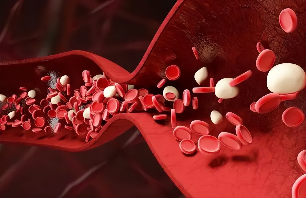 乳腺有增生，离不开肝郁、气滞、血瘀！我用疏肝散结法，化解增生