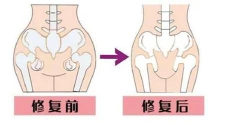 中年女性在家初学练瑜伽,中年练瑜伽对身体有好处吗
