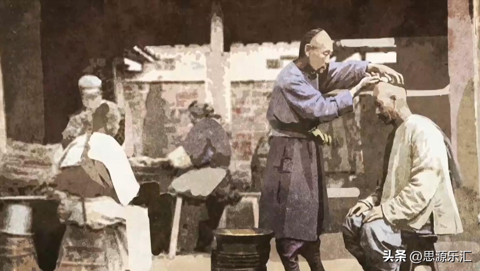 80后有多少秃顶了,90后的人秃头了