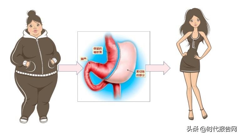 超火的“*肥药减**”司美格鲁肽注射液，所有人都适合吗？