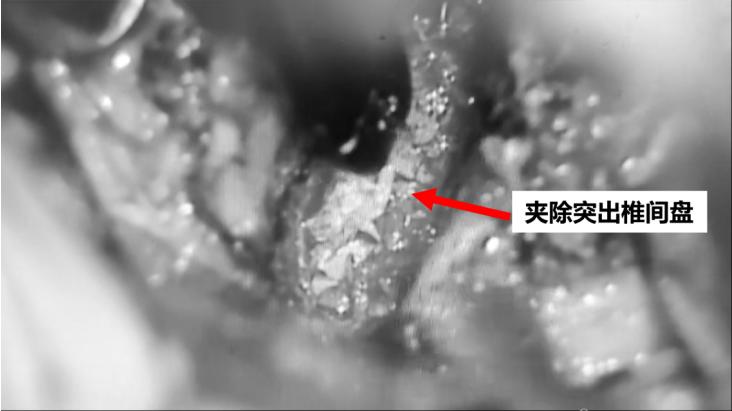 手痛手麻手僵硬是什么原因,手麻引起手指中节疼是什么原因