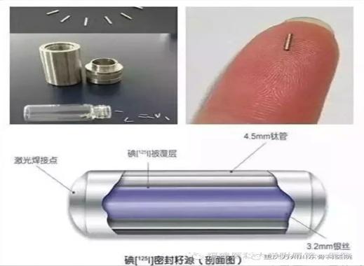 神奇的粒子—前列腺癌患者纷纷点赞的125I粒，术后三天即可出院。