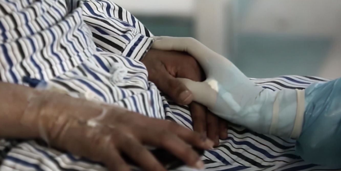 第一批新冠幸存者的故事,新冠第一批幸存者后遗症