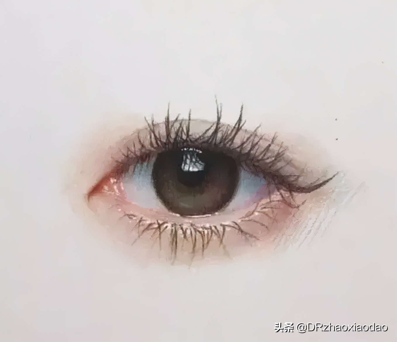 文献解读：红光治疗在近视防控中的作用