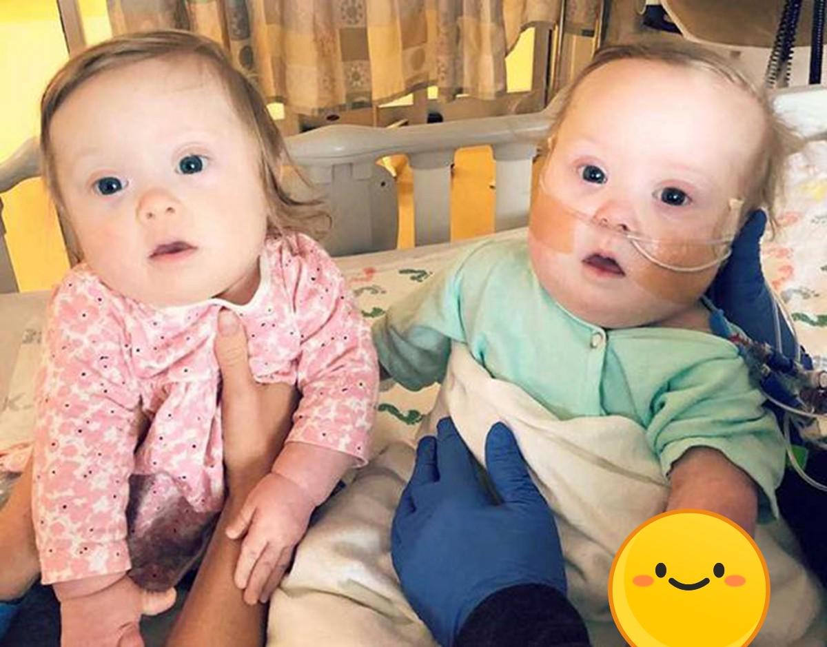 唐氏儿和正常胎儿的区别,唐氏儿和正常孩子的区别