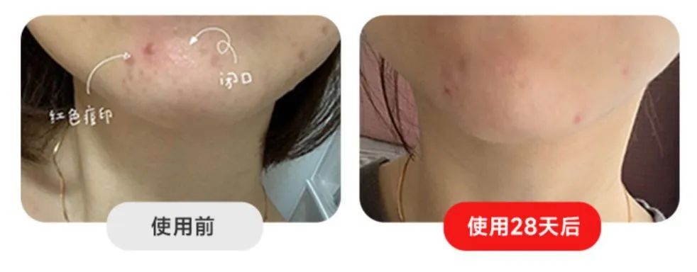 全网爆火的大牌灯美容仪到底有没有用？想变美的快看！附选购技巧