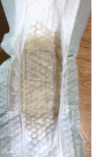 成人纸尿裤的正确使用方法,老人常穿纸尿裤有什么坏处