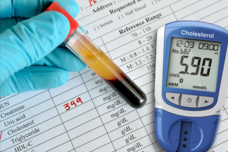 女性*处私**的润滑液是如何产生的？如何改善*处私**干燥？医生告诉你