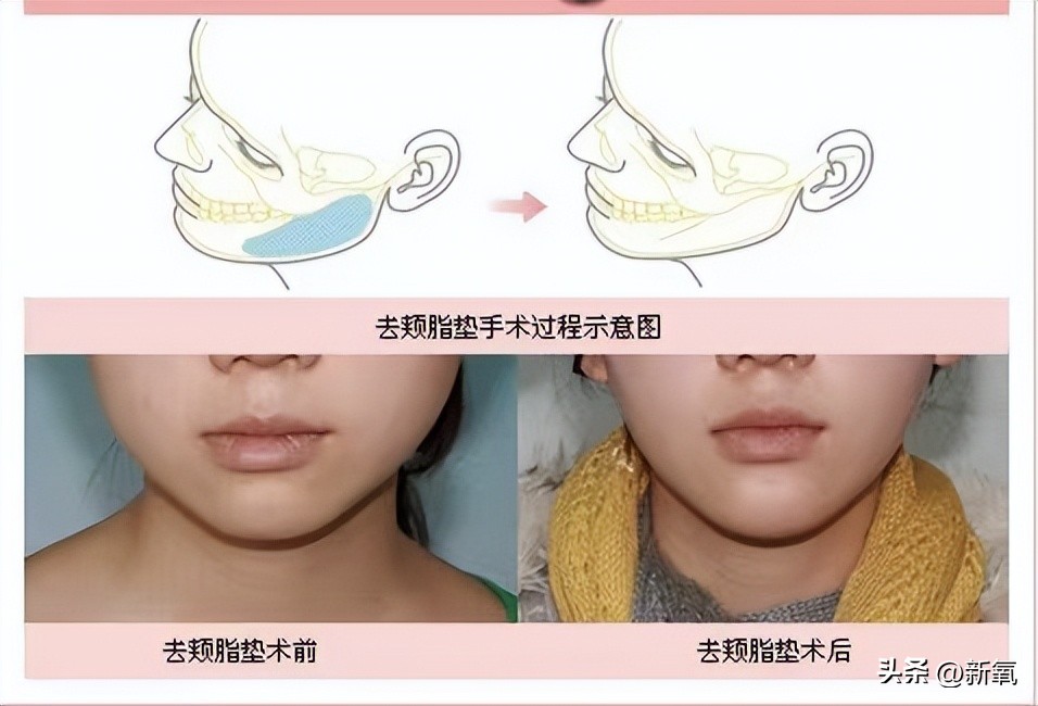 刘雯高级感,刘雯的脸型适合的风格