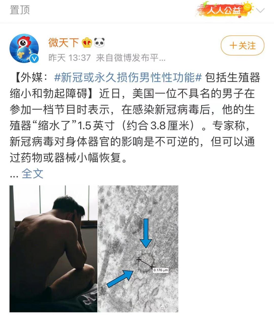 新冠损害男性生殖功能,新冠确诊病例男士后遗症