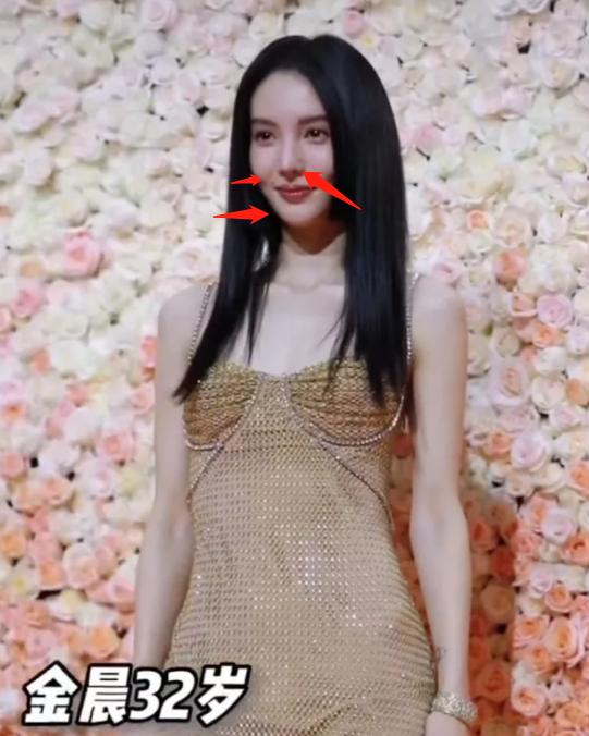 整容失败的女星蛇精脸,女星整容失败脸歪嘴斜