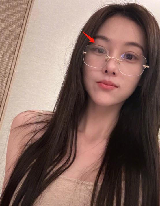 整容失败的女星蛇精脸,女星整容失败脸歪嘴斜