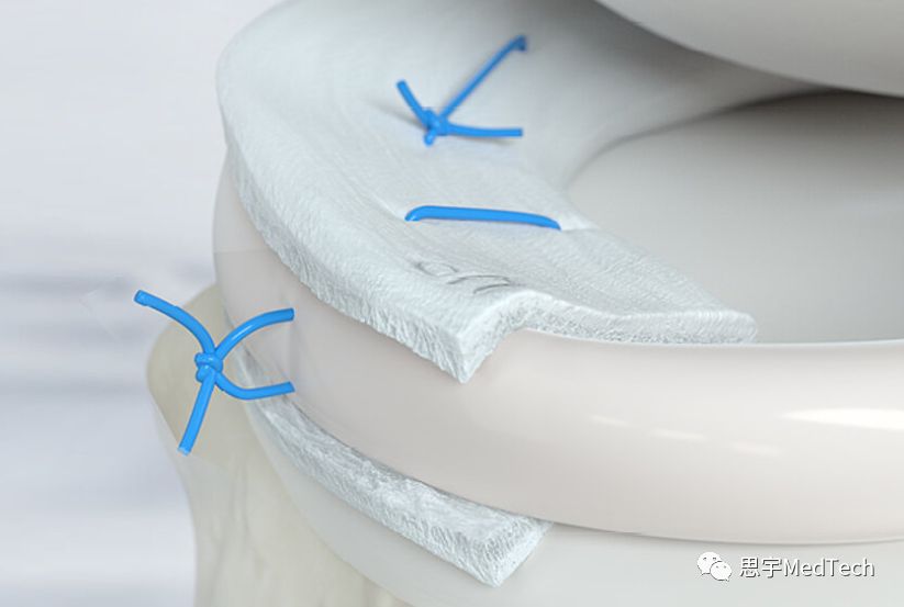 骨再生大咖:瑞士盖氏的故事