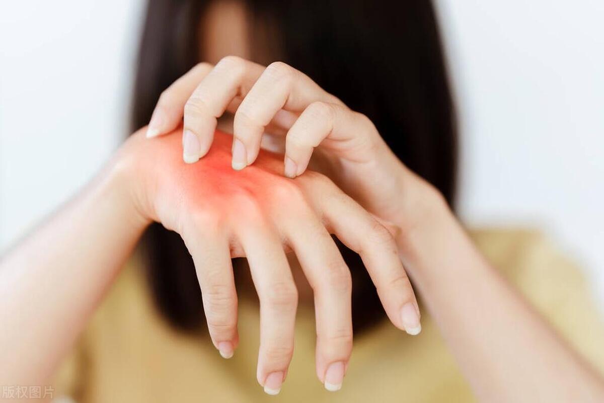 四种皮肤病要警惕,一摸皮肤就红的皮肤病