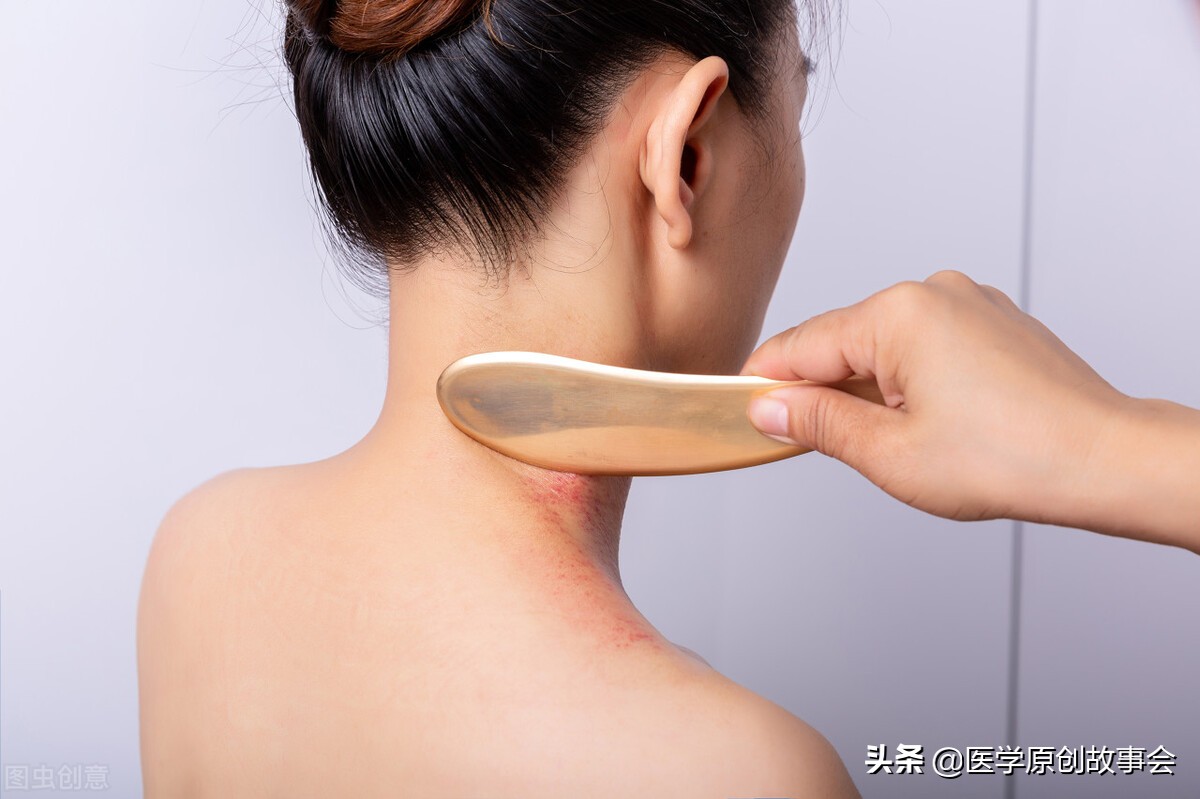 刮痧刮出来的淤血，是体内的毒素？告诉你真相，看完涨知识了