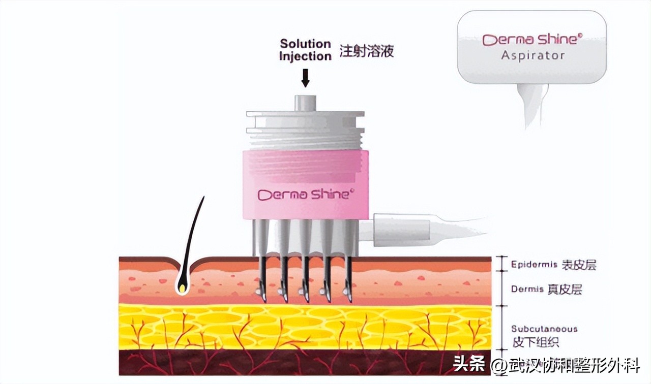 皮肤干燥痒痒起疹子怎么办,皮肤痒血燥是怎么引起的