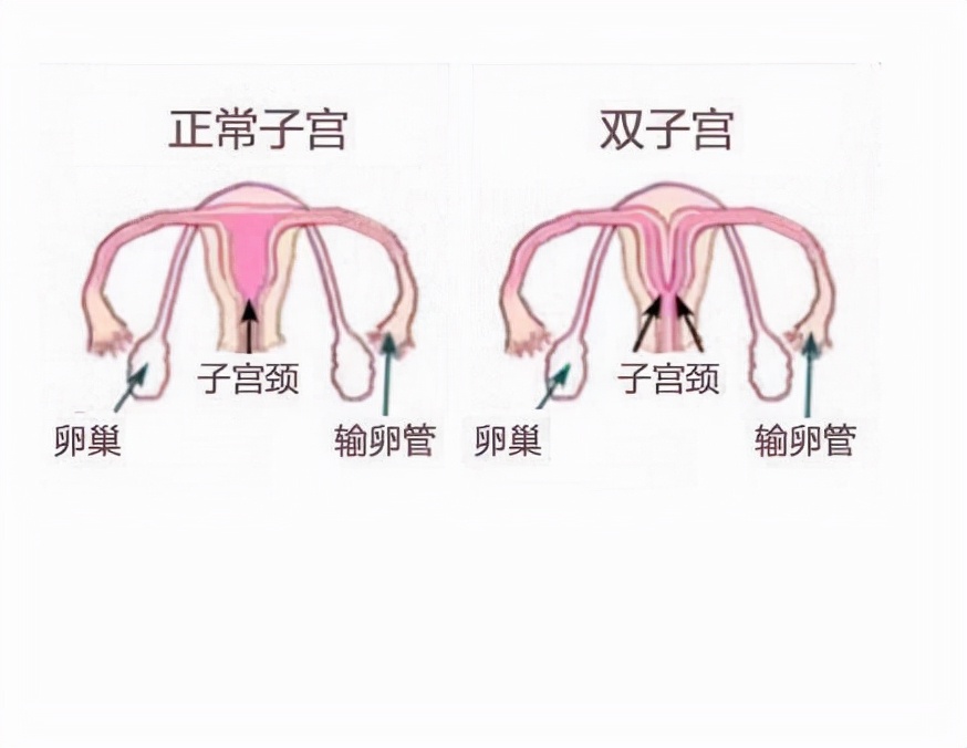 头胎刚满月又生二胎,头胎满月孕妇又要生产