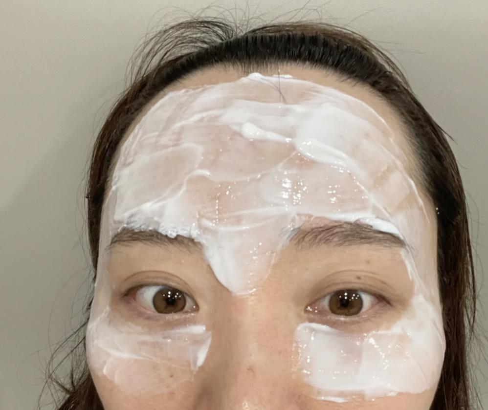 打玻尿酸需要敷麻药吗,打玻尿酸前要敷麻药吗