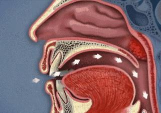口呼吸|听说变丑是因为习惯用嘴呼吸？
