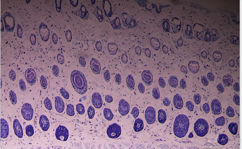 重组近交系小鼠的遗传结构：用于复杂性状分析的高分辨率共识图谱