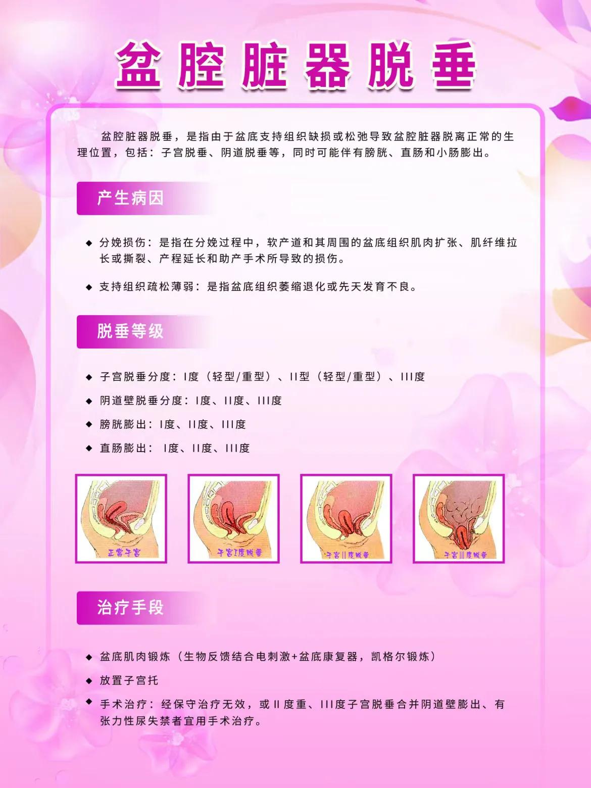 盆底康复治疗的过程,盆底康复的文章